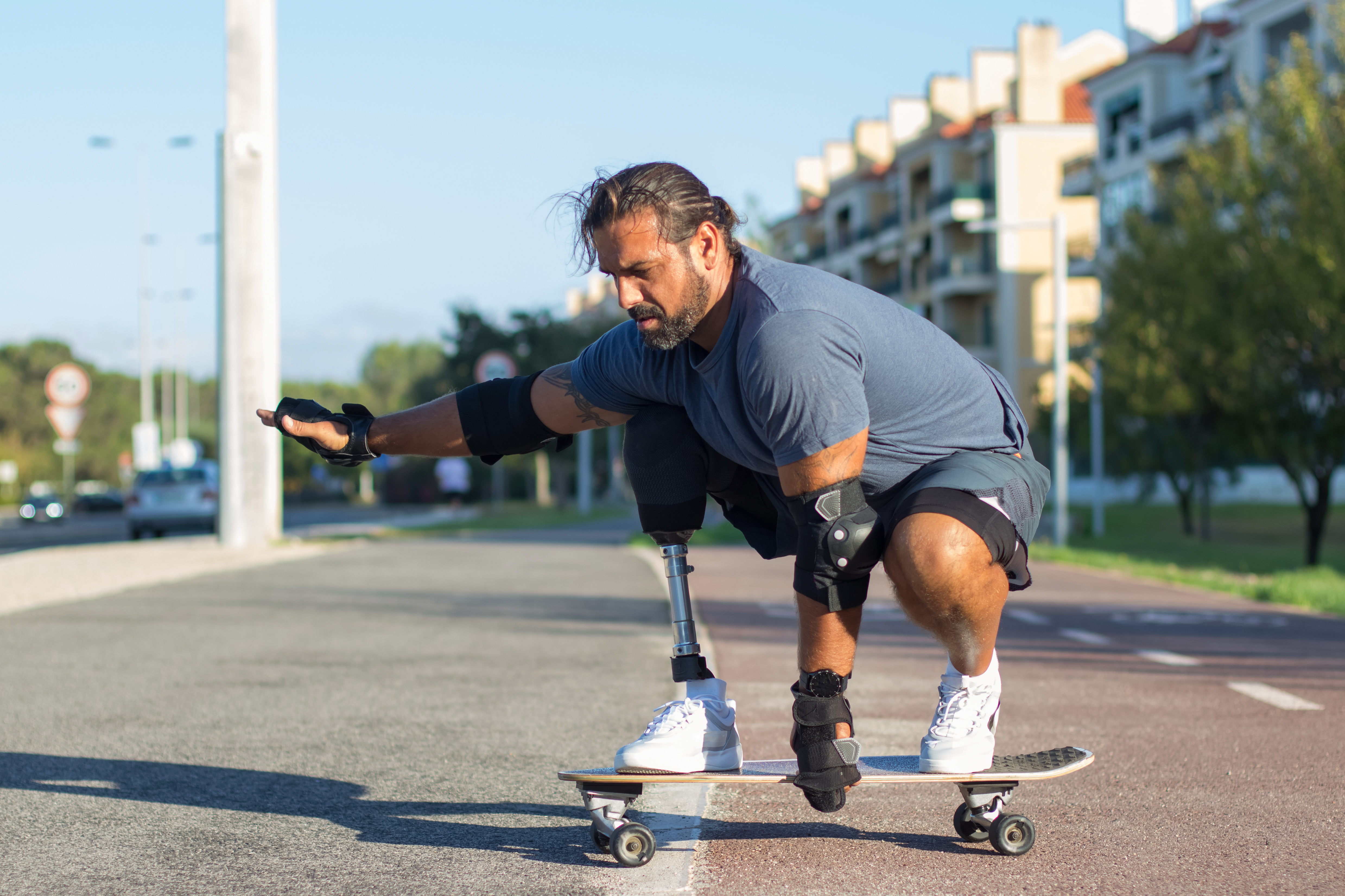 Prosthetic care consultation and guidance
